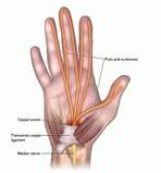 Image result for wrist tendon ligament carpal