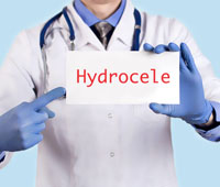 Hydrocele Ayurvedic treatment