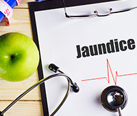Jaundice fever Ayurvedic treatment