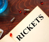 What is Rickets Ayurvedic treatment